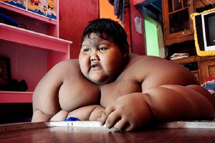 بالصور أسمن طفل في العالم تمنى احتراف كرة القدم، فخسر 106 كيلو غرام من وزنه
