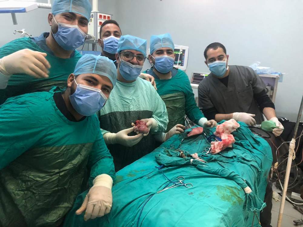 مستشفى جامعة المنيا تنجح فى أستئصال توأم مسخي ملتصق لطفلة في أسبوعها الأول لأم مصابة بكورونا